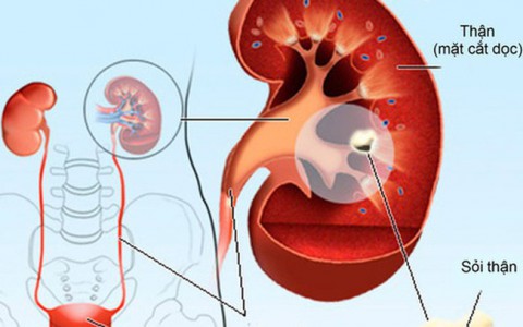 Nhắc bạn những điều quan trọng giúp thận khoẻ, tránh được các bệnh nguy hiểm